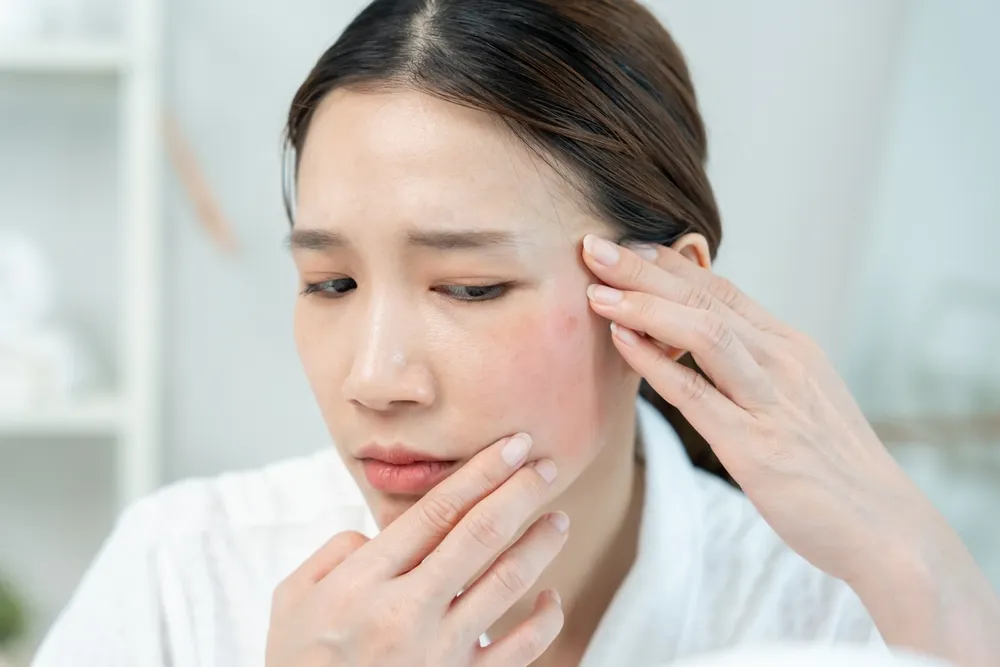 Woman examining an itchy red spot on her face